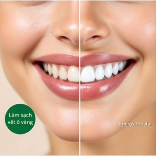 Combo Kem Đánh Răng Mát Lạnh Và Hỗ Trợ Trắng Răng Energy Crystal