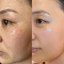 Kem mờ thâm nám,Fading Melasma Cream cao cấp, mờ nám, tàn nhang, vết thâm