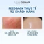 Serum B5 sena demar b5 microneedle ampoule giúp dưỡng ẩm, giảm nhăn, 50ml/100ml - hạn 2028 serum b5 senademar CD615