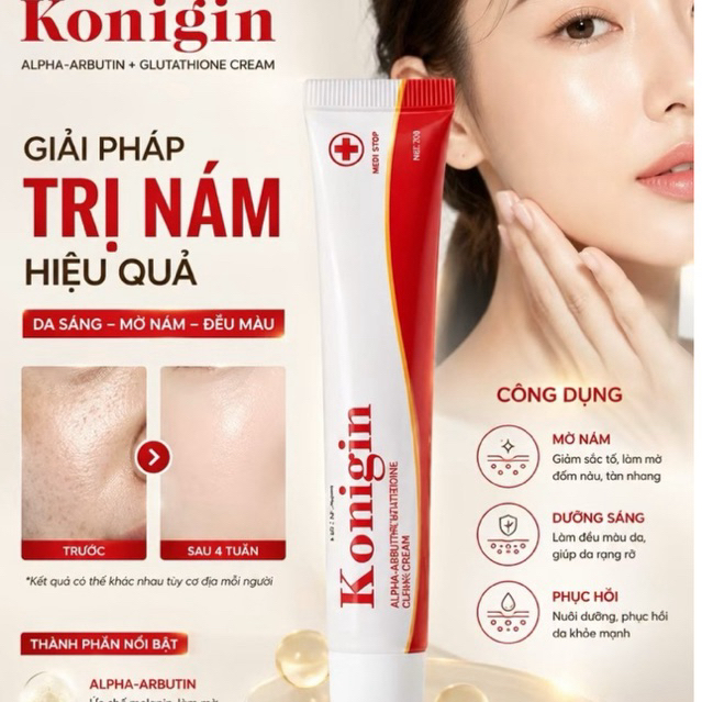Kem Nám Mờ Thâm Konigin  Dưỡng Trắng, Cấp Ẩm, Phục Hồi & Làm Đều Màu Da Tuýp 22g