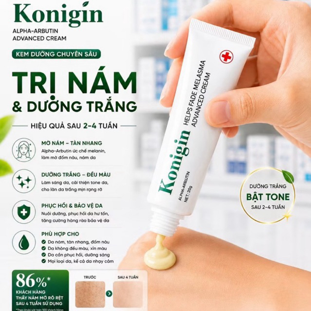 Kem Dưỡng Trắng Da Konigin Cấp Ẩm Sâu, Làm Sáng Da, Giảm Sạm Nám, Phục Hồi Da Khỏe Mịn Tuýp 30g