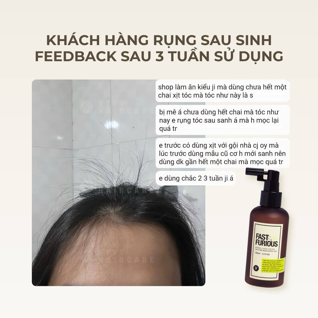 Xịt mọc tóc giảm rụng cải thiện mật độ tóc với Redensyl & Baicapil Fast & Furious™ Vyvyhaircare V 150ml