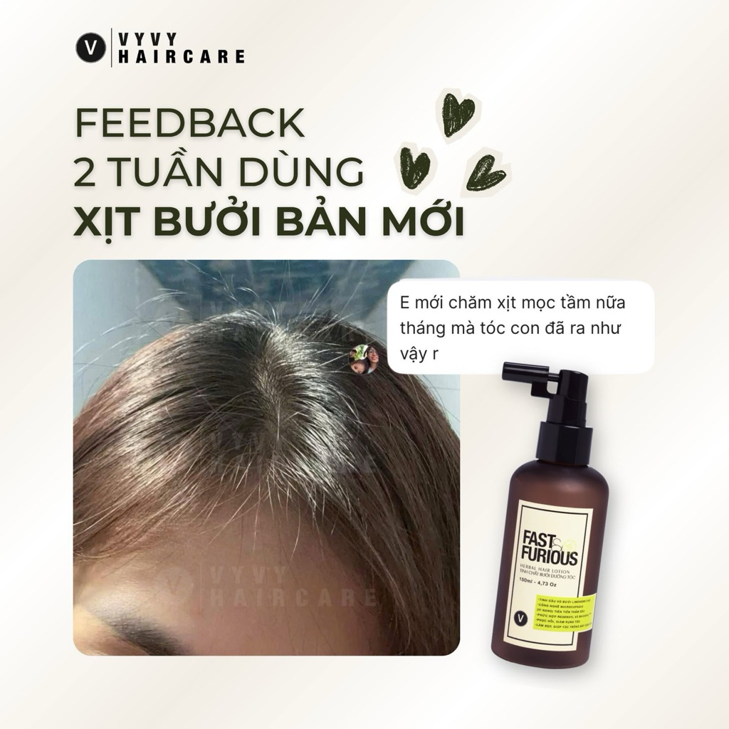 Xịt mọc tóc giảm rụng cải thiện mật độ tóc với Redensyl & Baicapil Fast & Furious™ Vyvyhaircare V 150ml