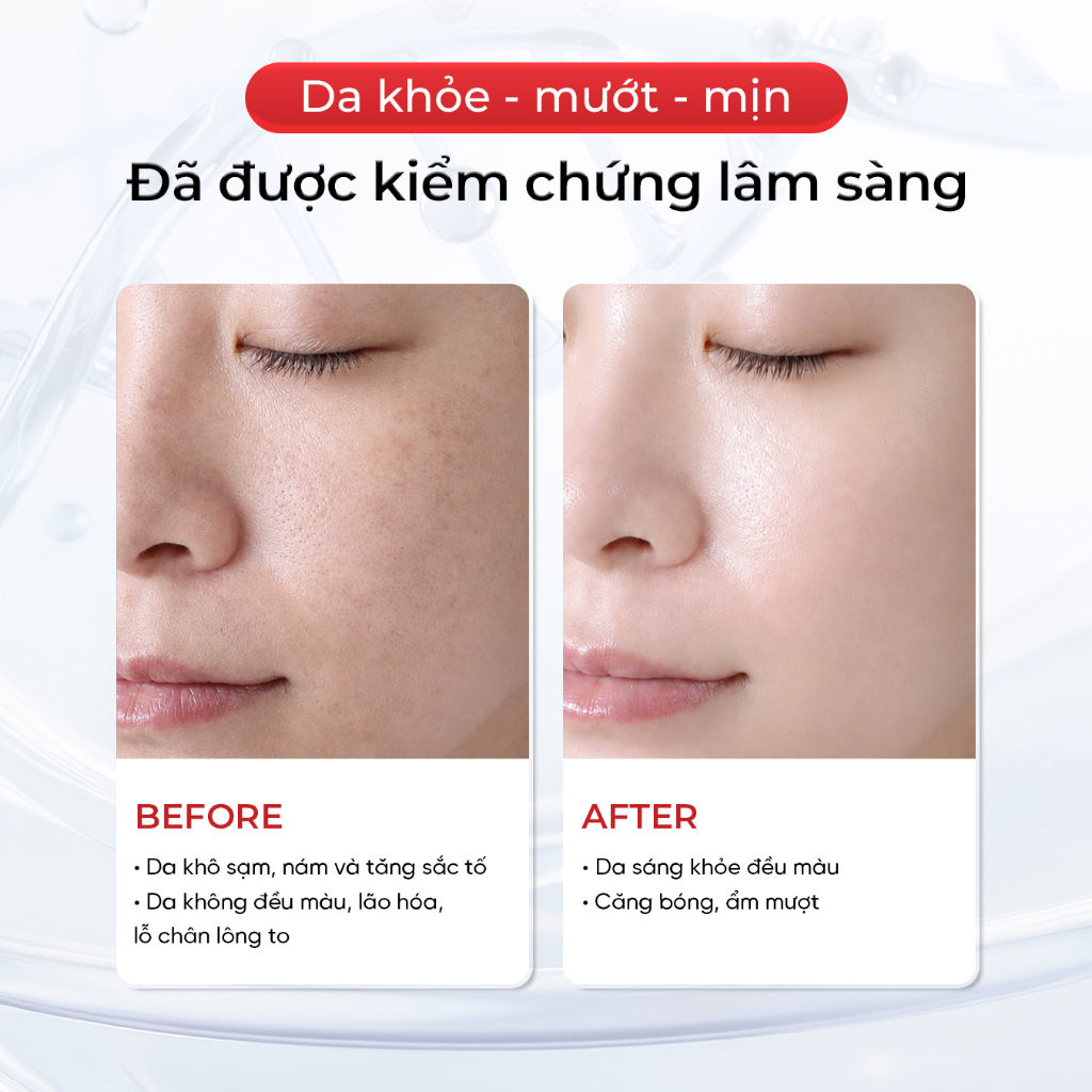 Tinh Chất Vi Kim Exosome SCCELL – Dưỡng Trắng Trẻ Hóa Da Toàn Diện, Cải Thiện Sắc Da, Làm Dịu 50 ml_70520