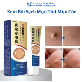 ( bán chạy) kem bôi rụng hết sạch mụn thịt thừa, mụn cóc, mụn nốt duồi và các mụn li ti quanh mắt