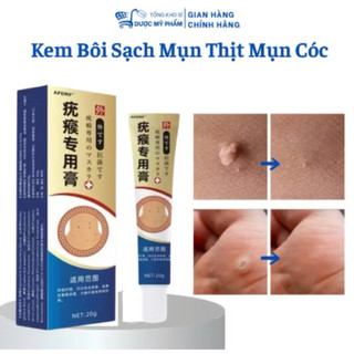 Kem bôI loại bỏ mụn thịt thừa mụn cóc nốt ruồi li ti quanh mắt thành phần thảo dược