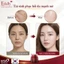 Kem Dưỡng Tái Sinh Phục Hồi Edally Ex, Hàng Chính Hãng cải thiện làm mờ nám tàn nhang trên da