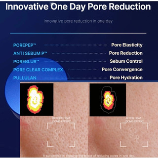 Kem dưỡng Medicube Zero Pore One Day Cream 50ml/thu nhỏ lỗ chân lông/cho da dầu mụn