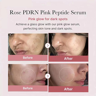 Tinh chất Medicube PDRN Pink Peptide Serum 30ml/giúp phục hồi và tái tạo làn da/da yếu và da lão hóa