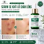 Serum BHA Salicylic Acid Se Khít Lỗ Chân Lông Giảm Mụn Đầu Đen Cho Da Dầu 30ml