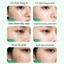 Serum BHA Salicylic Acid Se Khít Lỗ Chân Lông Giảm Mụn Đầu Đen Cho Da Dầu 30ml