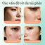 Serum BHA Salicylic Acid Se Khít Lỗ Chân Lông Giảm Mụn Đầu Đen Cho Da Dầu 30ml