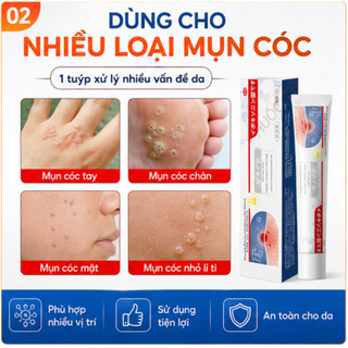 Kem bôi loại bỏ mụn thịt, mụn nhỏ ở cổ, mụn cóc, nách – Dưỡng da làm đẹp.