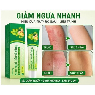 Kem Ngải Cứu và Gừng - Hỗ trợ giảm ngứa da, làm dịu vùng da khô ngứa, kháng khuẩn ngoài da