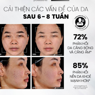 Sữa Rửa Mặt MD CARE Mandelic 5% Dạng Gel Sạch Sâu Và Tẩy Tế Bào Chết Nhẹ Nhàng 200ml - Bebeau