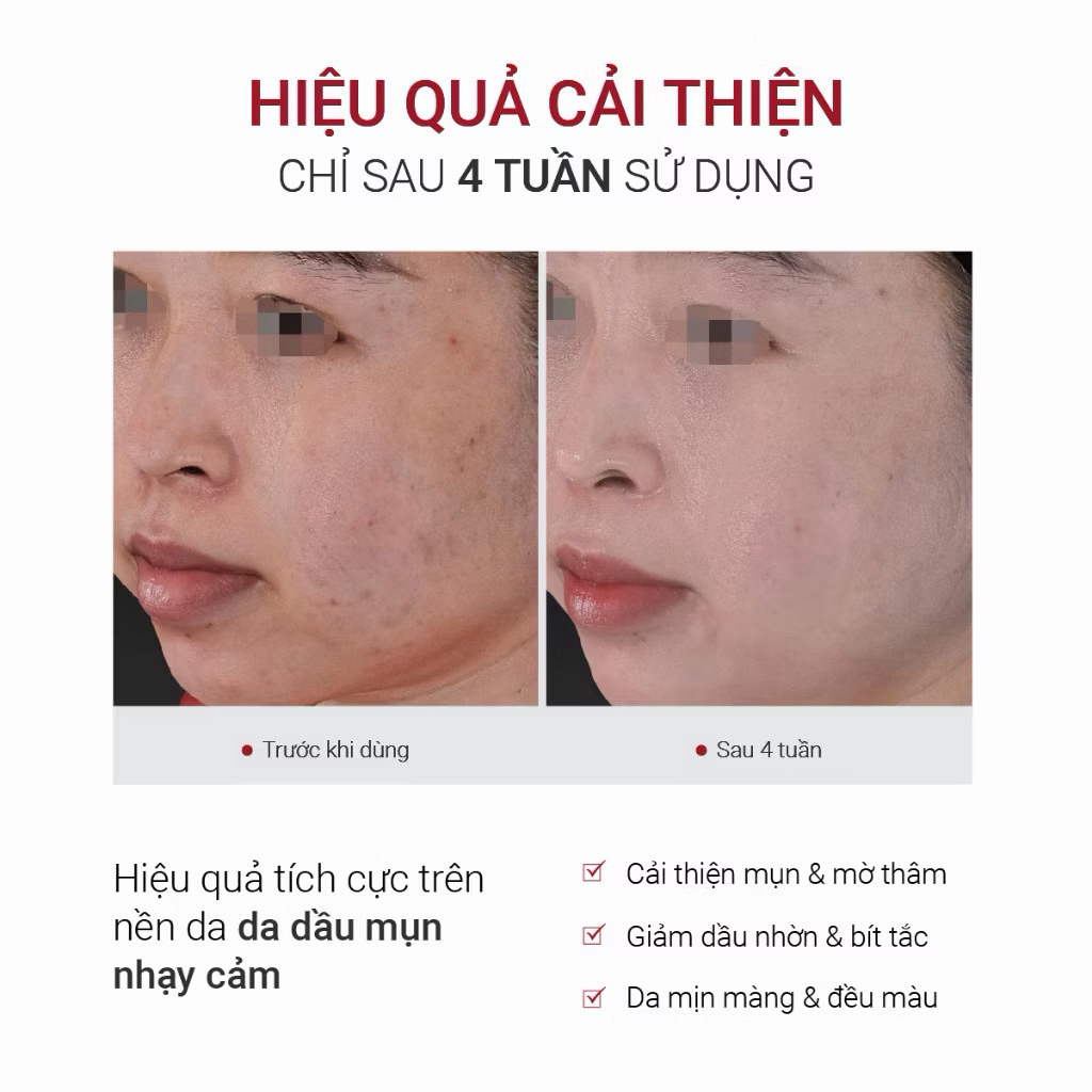 [New Version] [HÀNG CÔNG TY ] Fusion Retinol 0.3%, Tinh chất Retinol Dưỡng Da Săn Chắc & Mịn Màng 30ml