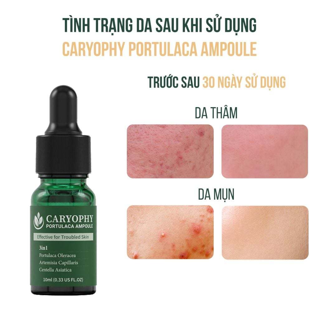 Tinh Chất giảm mụn Caryophy Portulaca Ampoule 30ml mờ thâm se khít lỗ chân lông vanilla cosmetics