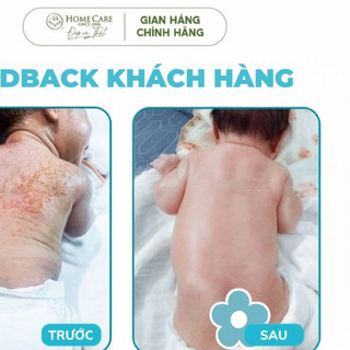 Combo 2 Kem CHỐNG Hăm, Chàm Cho Bé - Dịu Mẩn Ngứa, Ngừa Hăm, Bảo Vệ Và Phục Hồi Da Bé 5g