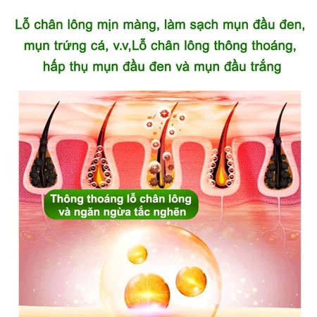 MUA 1 TẶNG 1 Mặt Nạ Duong m Dạng Sủi Bọt 10 giây bong bóng  Làm Sạch Sâu & Dưỡng Ẩm Tức Thì| Se Khít Lỗ Chân Lông Da Sán