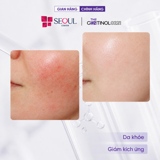 Gel dưỡng phục hồi PANTHENOL 5% GEL CALMING & SMOOTHES SKIN giúp làm dịu và dưỡng ẩm làn da The Gentinol 0221 50g