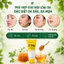 Sữa rửa mặt ngừa mụn Bạch Liên Honey chiết xuất mật ong 50g
