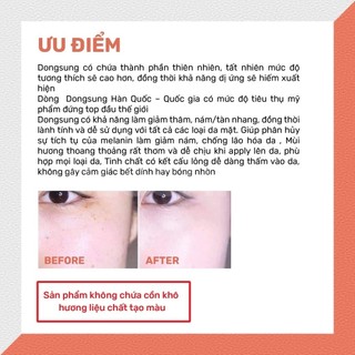 Kem Dưỡng DongSung Sáng Da Mờ Nám Serum Giảm Nám DONGSUNG Hàn Quốc - Kosmi Beauty