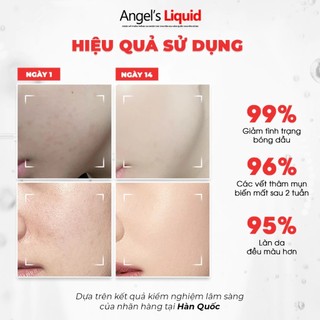 Serum Angel’s Liquid Glutathione + Niacinamide Cica Ampoule Kem Dưỡng Angel Liquid Glutathione Niacinamide -Kosmi Beauty