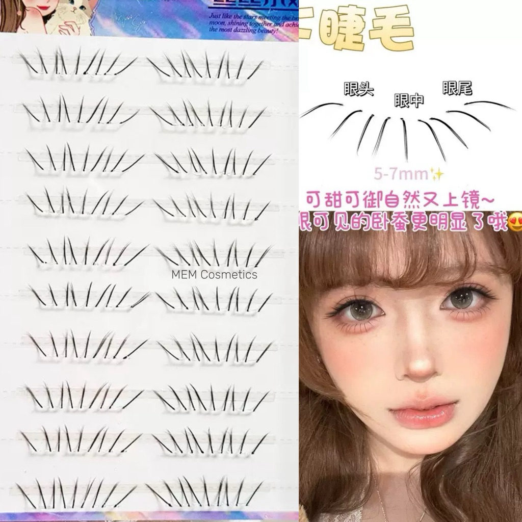 Mi Dưới, Mi Cụm LOUIG
