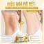 【BÁN CHẠY】Kem Trị Thâm Nách Camu Camu 50g Làm Sáng Da Mờ Thâm Dưỡng Ẩm Mịn Da Khử Mùi