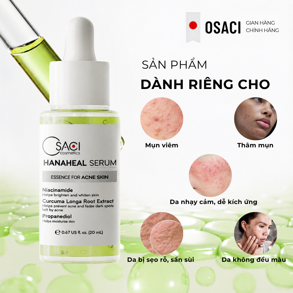 Serum Giảm Mụn Thâm, Mờ Sẹo Rỗ - Osaci Hana Heal Serum 20ml Dưỡng Sáng, Làm Dịu Cho Mọi Loại Da