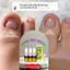 03 serum dưỡng móng, nấm móng, bọng móng, hư khoé, viêm phao móng