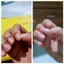 Dưỡng móng, nấm móng, bọng móng, hư khoé, viêm phao móng