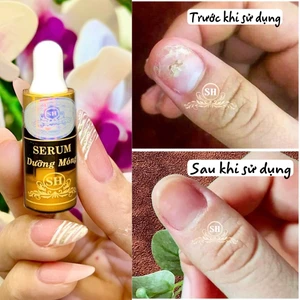 01 serum dưỡng móng, nấm móng, bọng móng, hư khoé, viêm phao móng