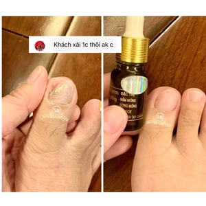 Dưỡng móng, nấm móng, bọng móng, hư khoé, viêm phao móng