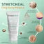 Kem Dưỡng Da StretcHeal 180ml – Hỗ Trợ Làm Mờ Rạn Da, Dưỡng Ẩm Và Tăng Độ Đàn Hồi