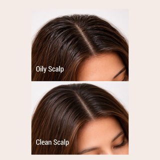 Dầu gội kiểm soát dầu MOREMO Caffeine Biome Shampoo For Oily Scalp công nghệ Anti-Sebum P, giảm rụng, phục hồi tóc 500ml