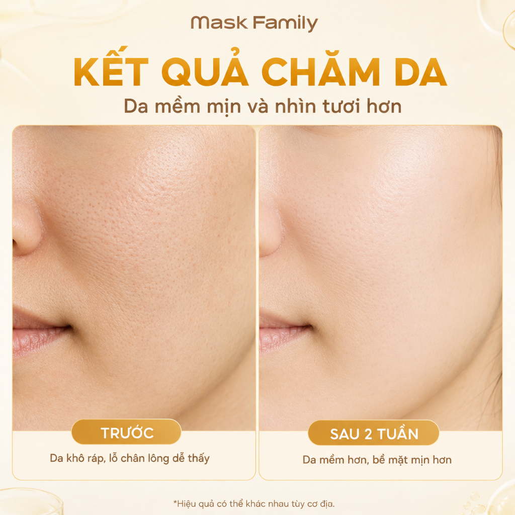 Mặt Nạ Trứng Gà Mask Family Se Khít Lỗ Chân Lông Mịn Da Cấp Ẩm Cho Làn Da Thô Ráp (25ml*10 Miếng)