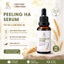 Peeling Ha Serum ( Giúp ngăn ngừa mụn, Se khít lỗ chân lông, Làm sáng da, Không sưng, Không bong )