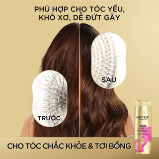 Dầu Xả PANTENE Siêu Dưỡng Ngăn Rụng Tóc Chai 480ML
