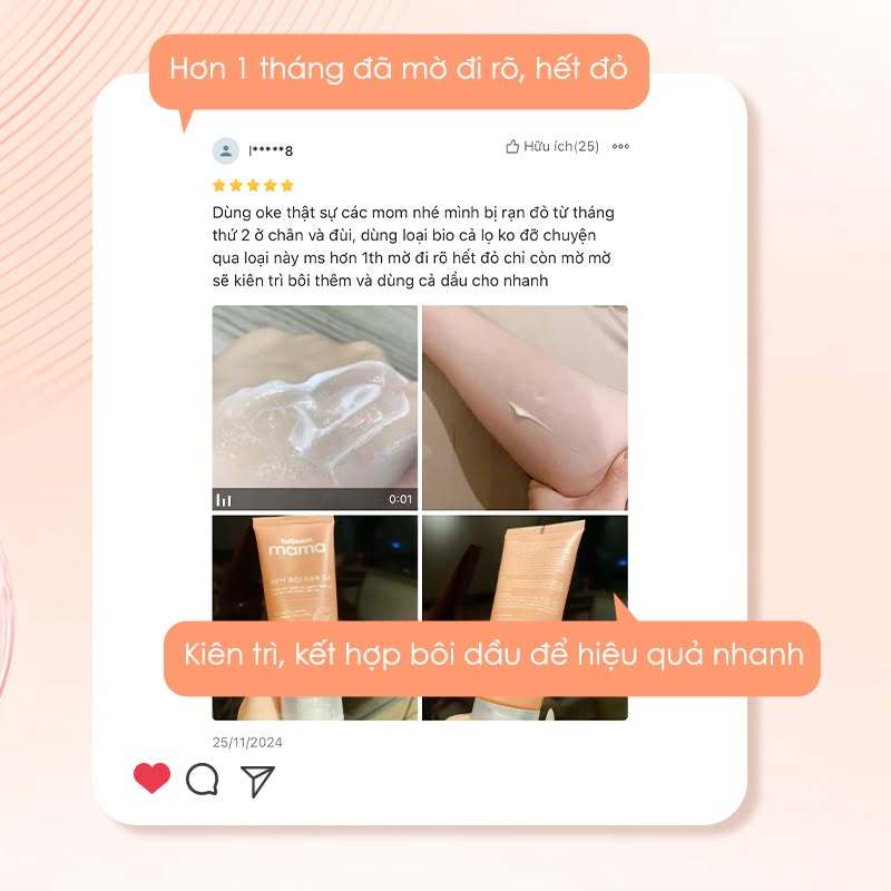 Kem Rạn Da Mờ Cả Rạn Đỏ Rạn Trắng Kutieskin Mama, Giảm Kích Thước Vết Rạn, Mờ Vết Rạn Lâu Năm