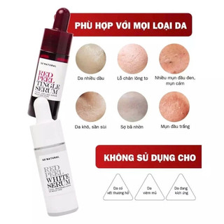 Tinh chất Peel da Red Peel Tingle Serum 11ml/ 35ml tẩy tế bào chết tái tạo & hỗ trợ làm sáng da