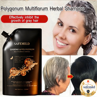 Dầu gội SAFEMILD hỗ trợ mọc tóc và giảm rụng, giúp nuôi dưỡng tóc chắc khỏe 300ml