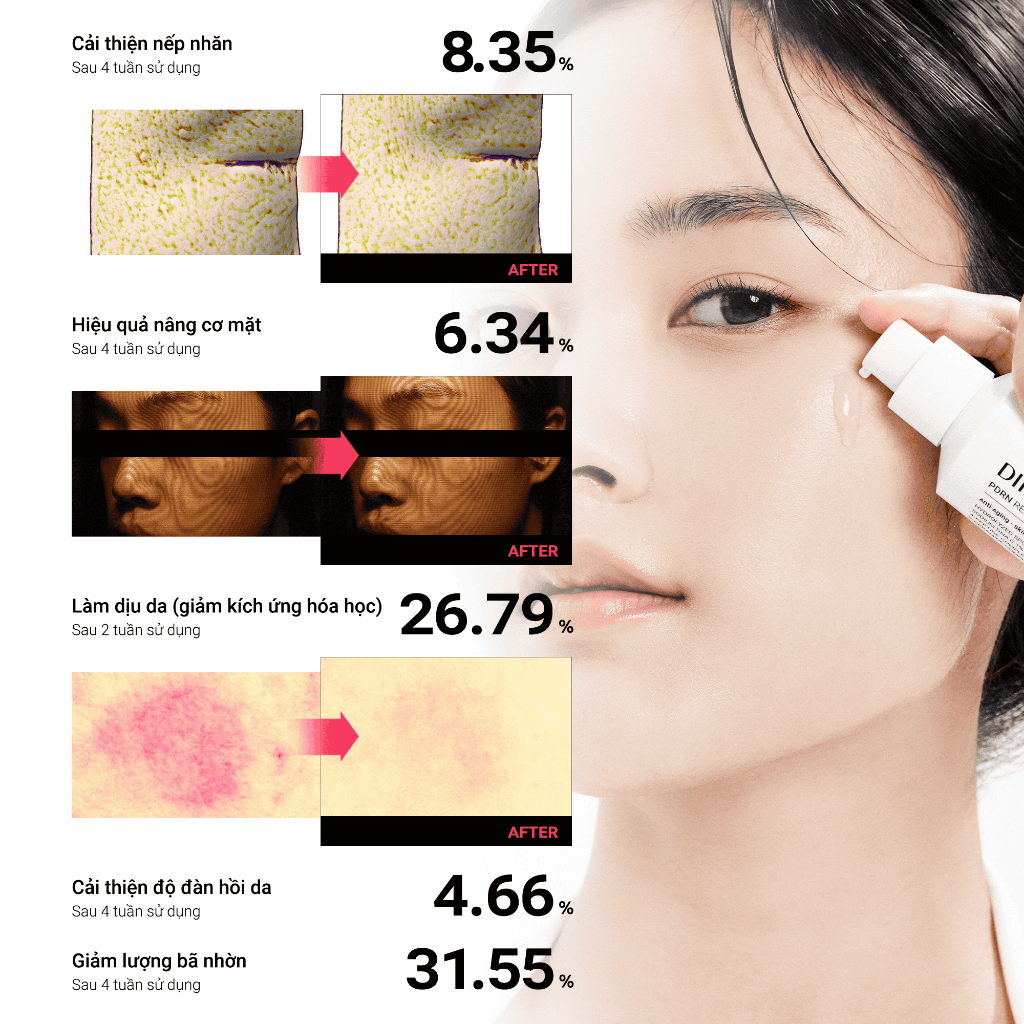 Serum PDRN & Vi Kim Bọt Biển Giúp Phục Hồi Và Hỗ Trợ Cải Thiện Nếp Nhăn Diinbi PDRN Repair Shot Serum 50ml | BigBuy360 - bigbuy360.vn