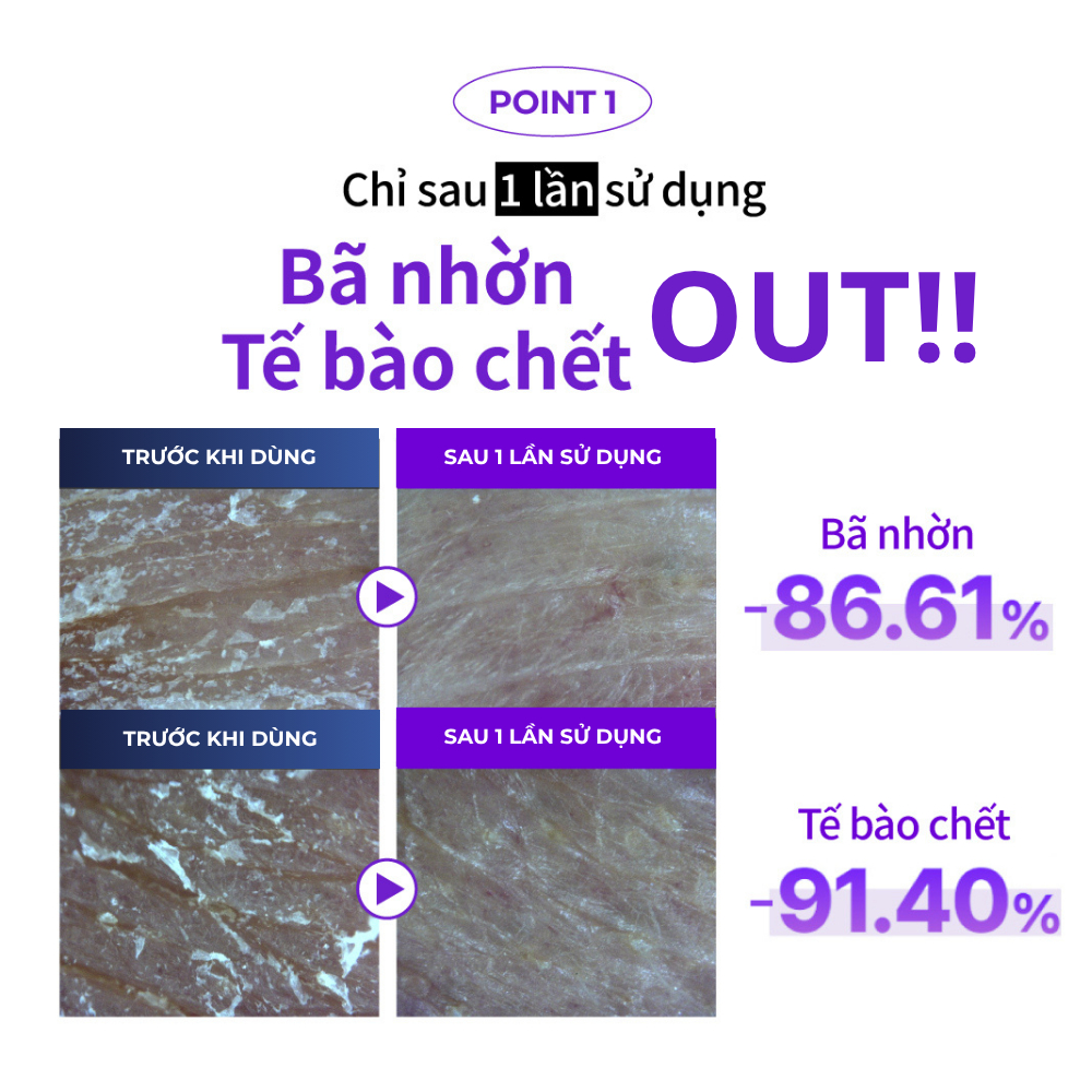 SÉT 3 GÓI SAMPLE | Sữa Rửa Mặt Cho Da Dầu Mụn IZEZE HYPER CSA CICA 2g Làm Sạch Bụi Mịn, Kiềm Dầu Hiệu Quả