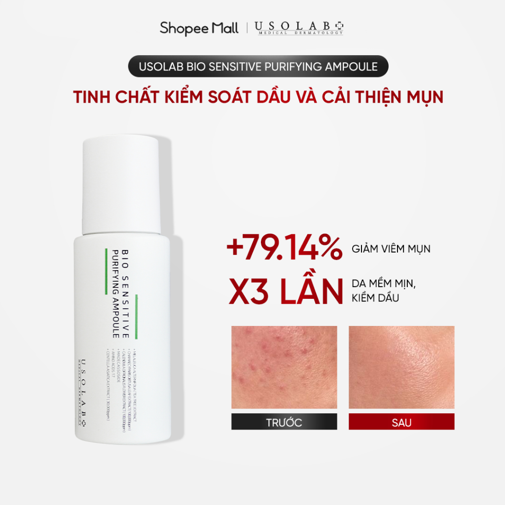 Tinh chất giảm dầu mụn Purifying Ampoule USOLAB -  Giúp kiềm dầu, giảm dầu mụn và giàm đỏ 50ml