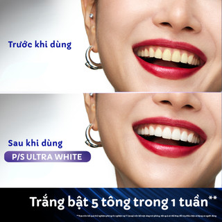 [MỚI]Kem đánh răng P/S Ultra White Trắng Bật 5 Tông 100g+Bàn Chải P/S Chăm Sóc Nướu+Nước Súc Miệng P/S Kháng Khuẩn 500ml