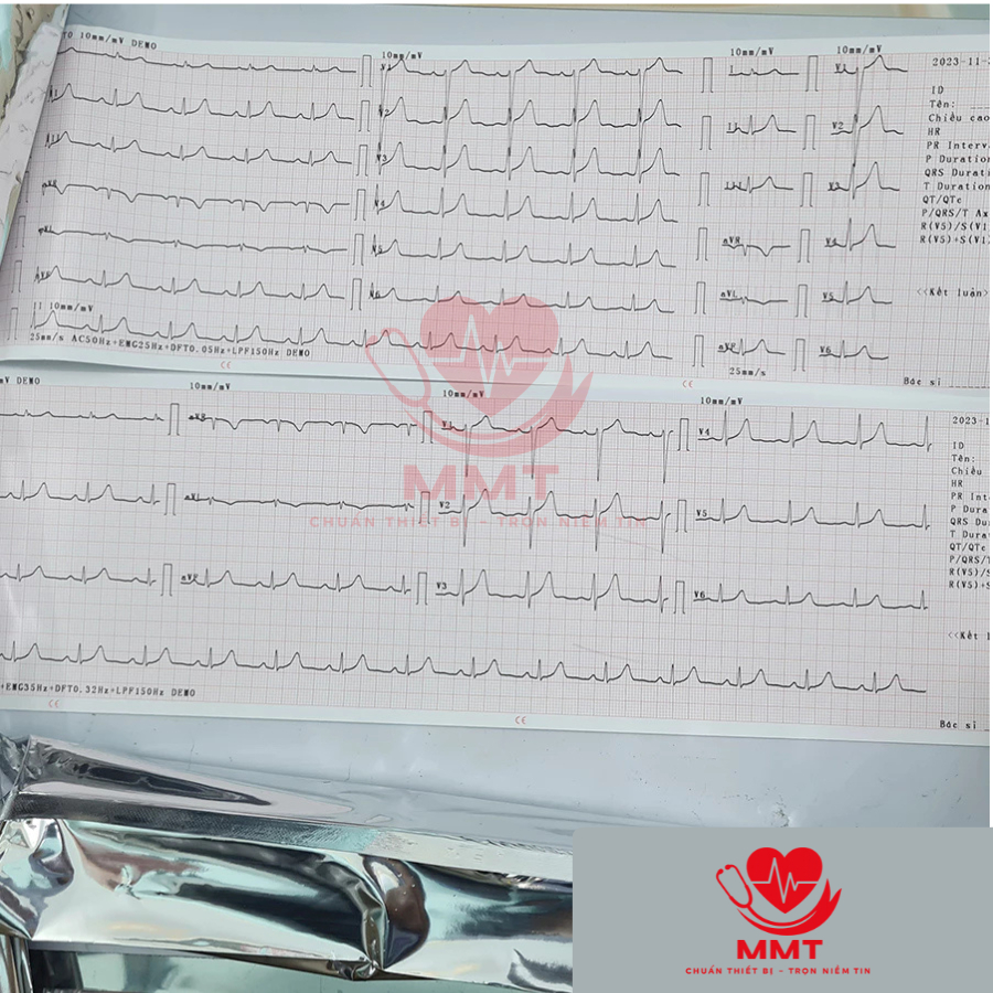 Giấy In Máy Điện Tim 6 Cần - ECG600G - Contec (1 cuộn)
