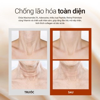 [CÔNG TY] Kem dưỡng da cổ VELLA Neck Cream Ultimate Age Killer Neck Cream