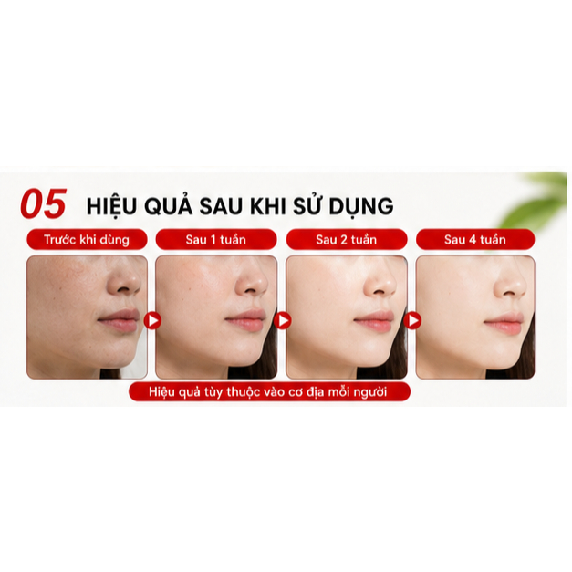 ✨Xà phòng axit Kojic - Xà phòng làm sáng và trắng da, làm mờ vết thâm nám và sẹo mụn, thích hợp sử dụng cho toàn thân.