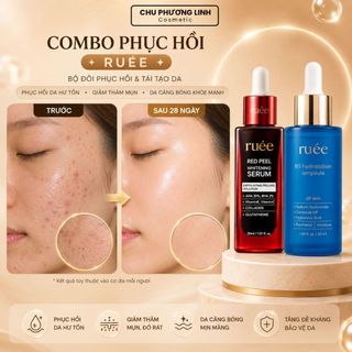 Combo Phục Hồi Da Serum B5 & Peel Da Ruee CB0273 - Phục Hồi Chuyên Sâu, Dưỡng Sáng Da, Giúp Da Căng Bóng
